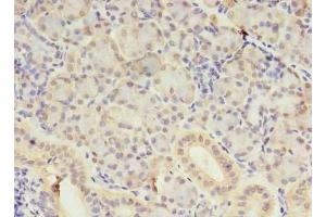 Immunohistochemistry of paraffin-embedded human pancreatic tissue using ABIN7170741 at dilution of 1:100 (SAMD3 antibody  (AA 62-197))