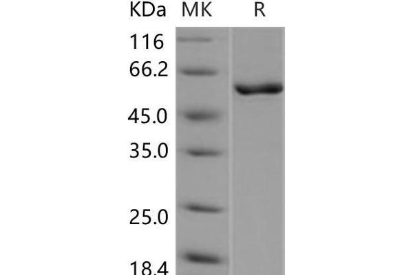 CAMK4 Protein