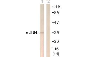 Immunohistochemistry analysis of paraffin-embedded human brain tissue using c-Jun (Ab-249) antibody. (C-JUN antibody)