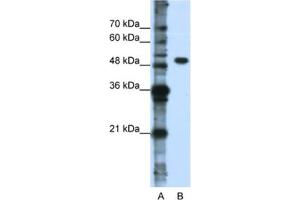 Western Blotting (WB) image for anti-DEAD (Asp-Glu-Ala-Asp) Box Polypeptide 47 (DDX47) antibody (ABIN2462367) (DDX47 antibody)