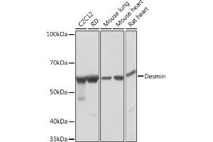 Western blot analysis of extracts of various cell lines, using Desmin Rabbit mAb (ABIN1678733, ABIN3018020, ABIN3018021 and ABIN7101569) at 1:1000 dilution. (Desmin antibody)