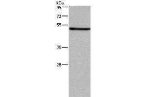 Western Blot analysis of LoVo cell using FOXA2 Polyclonal Antibody at dilution of 1:533 (FOXA2 antibody)