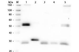 Western Blotting (WB) image for Sheep anti-Rat IgG (Heavy & Light Chain) antibody (Texas Red (TR)) - Preadsorbed (ABIN102180)