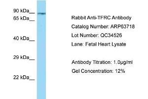 Western Blotting (WB) image for anti-Transferrin Receptor (p90, CD71) (TFRC) (N-Term) antibody (ABIN971870) (Transferrin Receptor antibody  (N-Term))