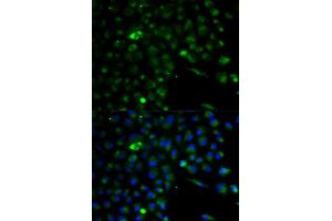 Immunofluorescence analysis of A549 cell using ALDH1A1 antibody. (ALDH1A1 antibody)