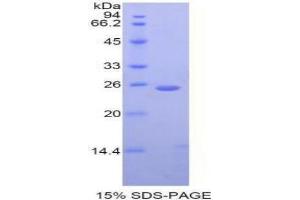 SDS-PAGE analysis of Monkey Cathepsin K Protein. (Cathepsin K Protein (CTSK))