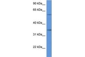 Image no. 1 for anti-CD34 (CD34) (AA 188-237) antibody (ABIN6746929) (CD34 antibody  (AA 188-237))