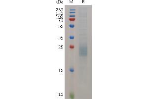 Mouse HBEGF (24-160) Protein, His Tag on SDS-PAGE under reducing condition. (HBEGF Protein (AA 24-160) (His tag))