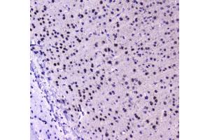 IHC testing of FFPE mouse brain tissue with RUNX1T1 antibody at 1ug/ml. (RUNX1T1 antibody)