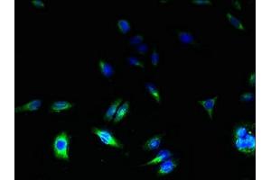 Immunofluorescent analysis of HepG2 cells using ABIN7171866 at dilution of 1:100 and Alexa Fluor 488-congugated AffiniPure Goat Anti-Rabbit IgG(H+L) (TSPAN31 antibody  (AA 94-173))