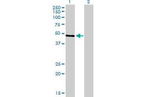 Western Blotting (WB) image for anti-Tumor Protein P53 (TP53) (AA 94-202) antibody (ABIN598982) (p53 antibody  (AA 94-202))