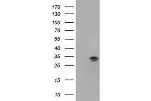 Western Blotting (WB) image for anti-Four and A Half LIM Domains 1 (FHL1) antibody (ABIN1500974) (FHL1 antibody)