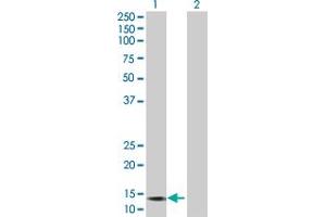 Lane 1: GALNT3 transfected lysate ( 15. (GALNT3 293T Cell Transient Overexpression Lysate(Denatured))