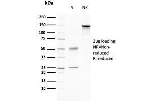 SDS-PAGE Analysis Purified CD80 Mouse Monoclonal Antibody (C80/2776). (CD80 antibody  (AA 35-142))