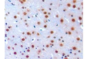 IHC-P analysis of Mouse Cerebrum Tissue, with DAB staining. (IRF1 antibody  (AA 44-319))