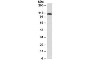 Western blot testing of human liver lysate with BMPR2 antibody at 1ug/ml. (BMPR2 antibody)