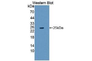 Western blot analysis of the recombinant protein. (Grancalcin antibody  (AA 39-220))