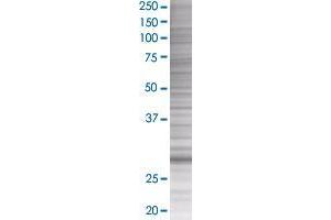 MYO3A transfected lysate. (MYO3A 293T Cell Transient Overexpression Lysate(Denatured))