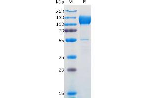 NTRK3 Protein (AA 32-429) (Fc Tag)