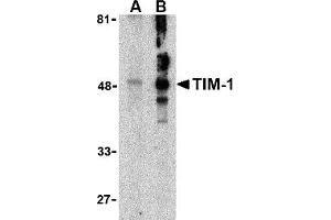 Western Blotting (WB) image for anti-Hepatitis A Virus Cellular Receptor 1 (HAVCR1) (N-Term) antibody (ABIN1031616) (HAVCR1 antibody  (N-Term))