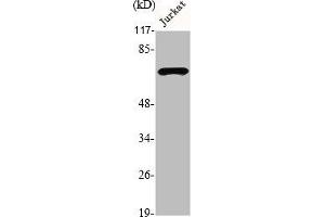 Western Blot analysis of Jurkat cells using DMPK Polyclonal Antibody (DMPK antibody  (N-Term))