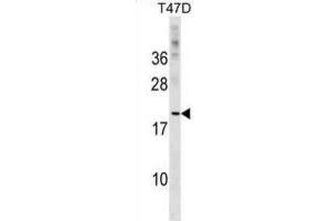 Western Blotting (WB) image for anti-C-Type Lectin Domain Family 4, Member D (CLEC4D) antibody (ABIN2999516) (CLEC4D antibody)