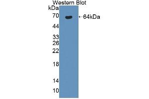 Western blot analysis of the recombinant protein. (Bestrophin 1 antibody  (AA 292-585))