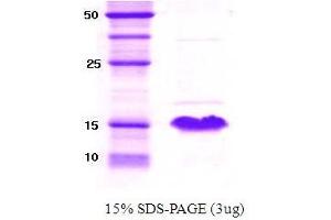 Figure annotation denotes ug of protein loaded and % gel used. (alpha Synuclein 61140 (active) Protein)