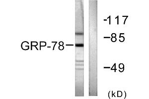 Western blot analysis of extracts from COS7 cells, using GRP78 antibody (#C0217). (GRP78 antibody)