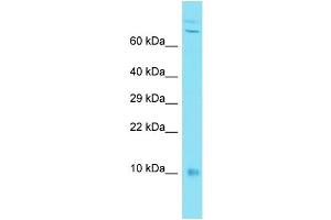 C7orf49 antibody  (N-Term)