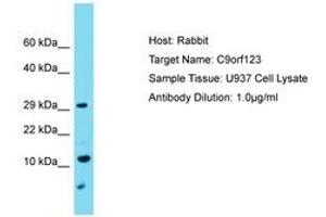 Image no. 1 for anti-Chromosome 9 Open Reading Frame 123 (C9ORF123) (C-Term) antibody (ABIN6750724) (C9orf123 antibody  (C-Term))