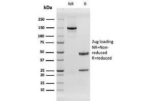 SDS-PAGE Analysis Purified EGFR Recombinant Mouse Monoclonal Antibody (rGFR/1667). (Recombinant EGFR antibody)