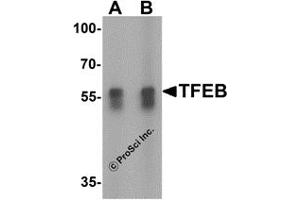 Western Blotting (WB) image for anti-Transcription Factor EB (TFEB) (N-Term) antibody (ABIN1031613) (TFEB antibody  (N-Term))