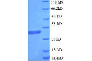 SDS-PAGE (SDS) image for Apolipoprotein C-III (APOC3) (AA 21-99) protein (His tag) (ABIN5709065) (APOC3 Protein (AA 21-99) (His tag))