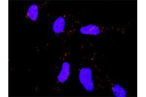 Proximity Ligation Analysis of protein-protein interactions between CDC42 and MAPK8. (JNK antibody  (AA 318-427))