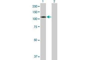 Lane 1: BEND2 transfected lysate ( 87. (CXorf20 293T Cell Transient Overexpression Lysate(Denatured))