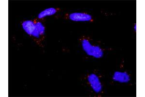 Proximity Ligation Analysis of protein-protein interactions between EPAS1 and SMAD3. (SMAD3 antibody  (AA 1-110))