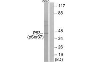 Western Blotting (WB) image for anti-Tumor Protein P53 (TP53) (pSer37) antibody (ABIN2888500) (p53 antibody  (pSer37))