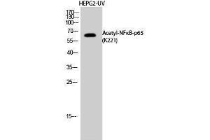Western Blotting (WB) image for anti-Nuclear Factor-kB p65 (NFkBP65) (acLys221) antibody (ABIN3178883) (NF-kB p65 antibody  (acLys221))