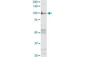 Immunoprecipitation of ITGB6 transfected lysate using anti-ITGB6 MaxPab rabbit polyclonal antibody and Protein A Magnetic Bead , and immunoblotted with ITGB6 purified MaxPab mouse polyclonal antibody (B01P) . (ITGB6 antibody  (AA 1-788))