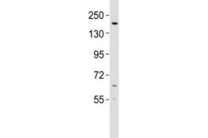 Western blot testing of KDM6B antibody at 1:2000 dilution + mouse lung lysate; Predicted molecular weight ~176 kDa. (Kdm6b antibody  (AA 879-912))