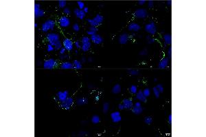 Immunocytochemistry/Immunofluorescence analysis using Mouse Anti-LRP4 Monoclonal Antibody, Clone S207-27 (ABIN2483388). (LRP4 antibody  (AA 26-350) (HRP))