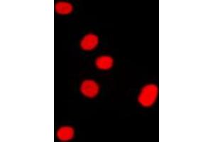 Immunofluorescent analysis of DLX5 staining in Raw264. (DLX5 antibody  (Center))
