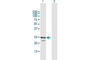 Western Blot analysis of HPGD expression in transfected 293T cell line by HPGD MaxPab polyclonal antibody. (HPGD antibody  (AA 1-266))