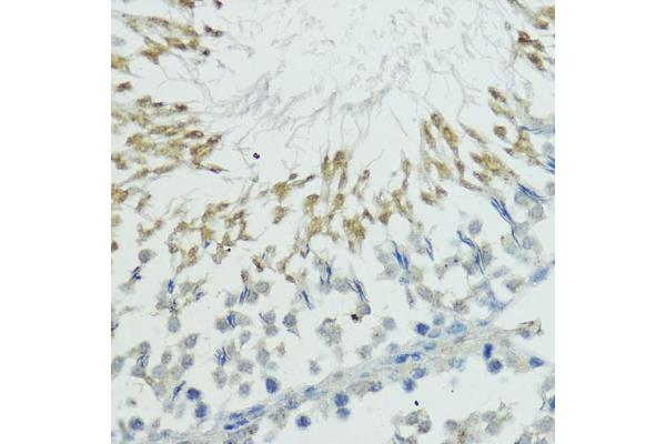 TRIP12 antibody  (AA 1-240)