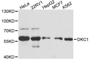 Western blot analysis of extracts of various cell lines, using DKC1 antibody (ABIN6290283) at 1:3000 dilution. (DKC1 antibody)