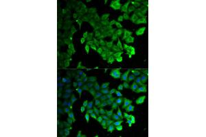 Immunofluorescence analysis of HeLa cells using MAP1LC3A antibody (ABIN5973272). (MAP1LC3A antibody)