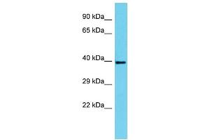 Host: Rabbit Target Name: SERTAD4 Sample Type: HepG2 Whole Cell lysates Antibody Dilution: 1. (SERTAD4 antibody  (C-Term))