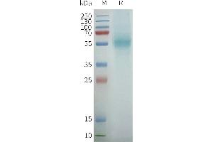 Human PT-Nanodisc, Flag Tag on SDS-PAGE (PTGER4 Protein)