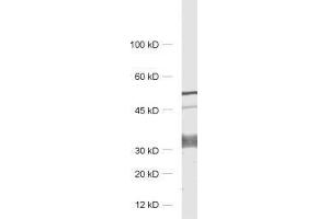 dilution: 1 : 1000, sample: rat brain homogenate (GPM6A antibody)